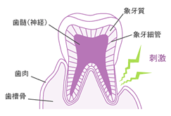 知覚過敏